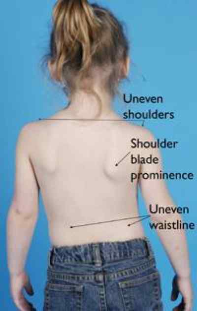 Uneven Shoulder - Len Academy